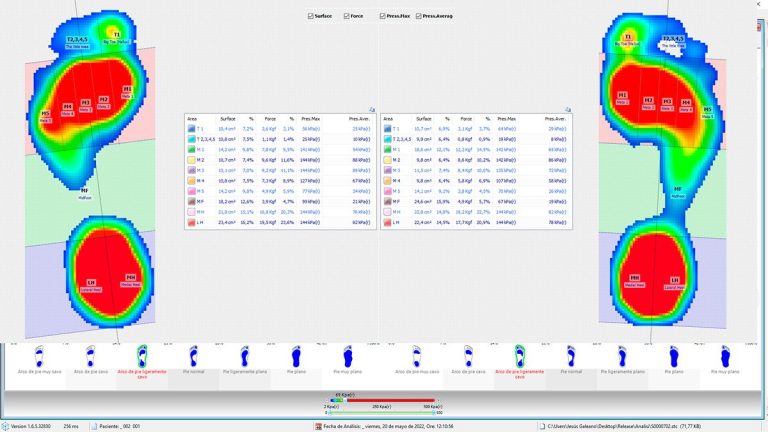 análisis de las diferentes areas en la bhuella de presiones en posición estática sobre la plataforma de presiones